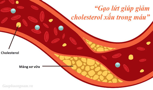 Gạo lứt giúp giảm cholesterol xấu trong máu